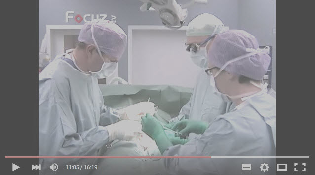 Video Vasovasostomie Focus TV